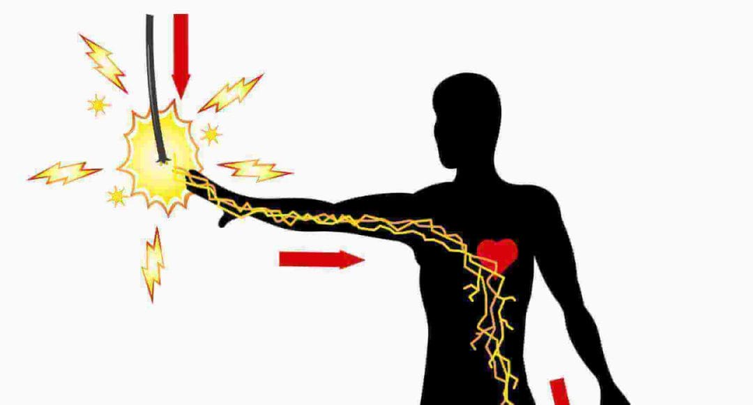 electrical injury graphic